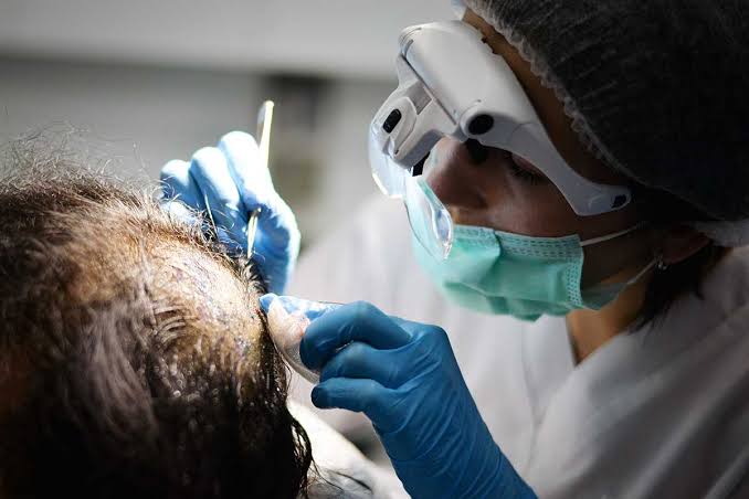 Exploring the Future of Hair Restoration: The Promise of Stem Cell Therapy in London